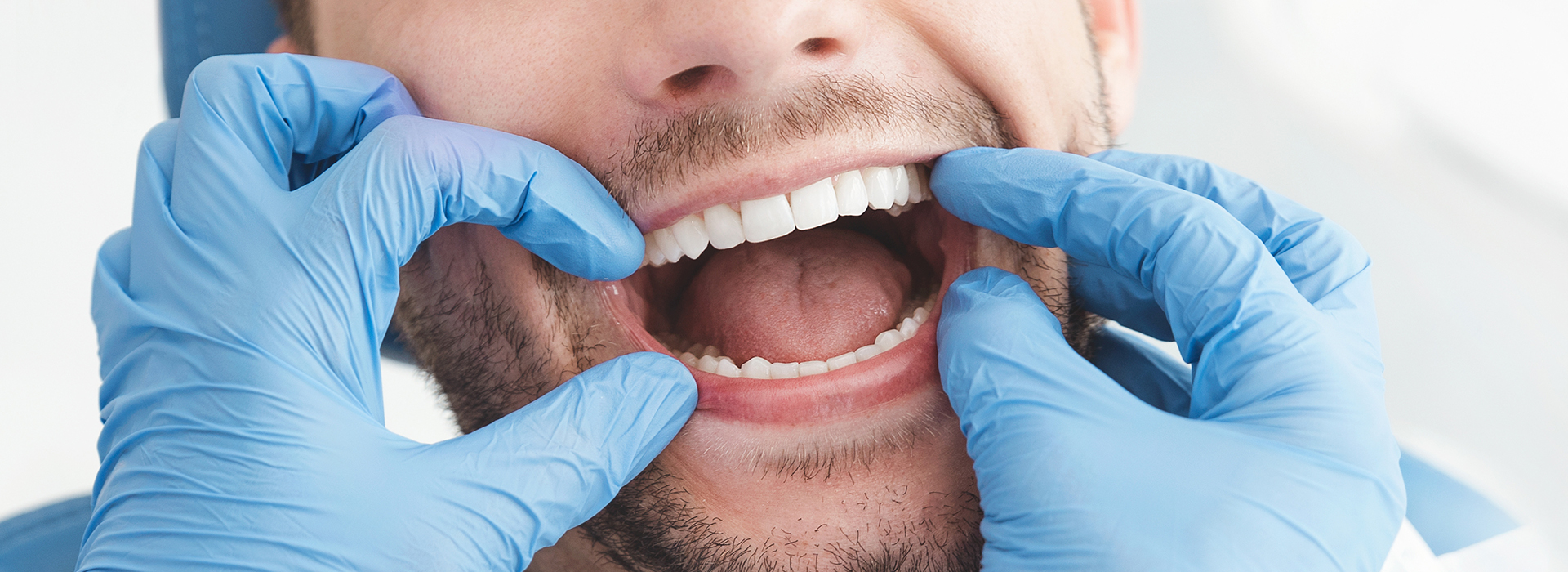 The image shows a man with his mouth wide open, possibly during a dental examination or procedure, wearing blue gloves and a white mask, with medical equipment visible around him.