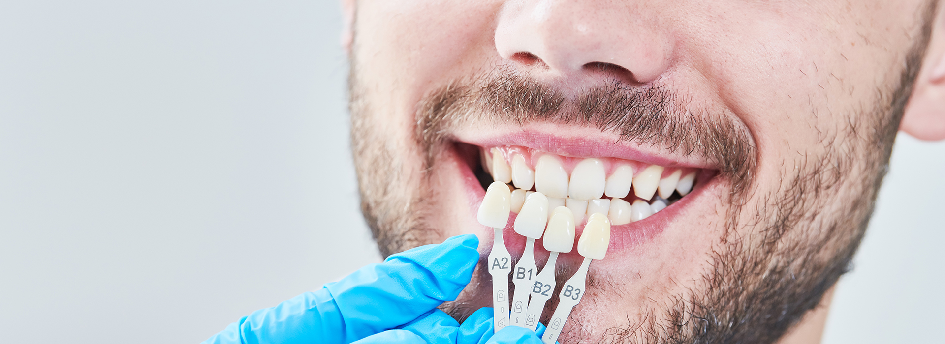 The image shows a person with a toothy smile holding an object that appears to be a dental implant.