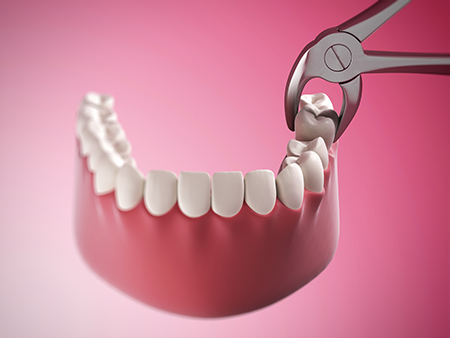A close-up photograph of a dental implantation process with a pinkish gum line and a precision tool in action.