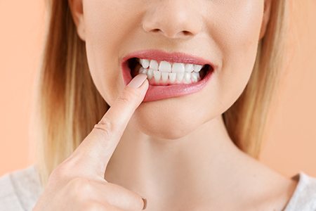 A woman with her finger on her teeth is shown in an advertisement for dental care products.